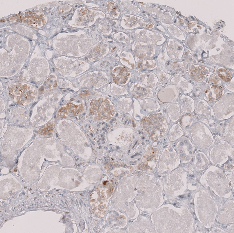 Perilipin-3/TIP47 Antibody - BSA Free Immunohistochemistry-Paraffin: Perilipin-3/TIP47 Antibody [NBP1-87871]