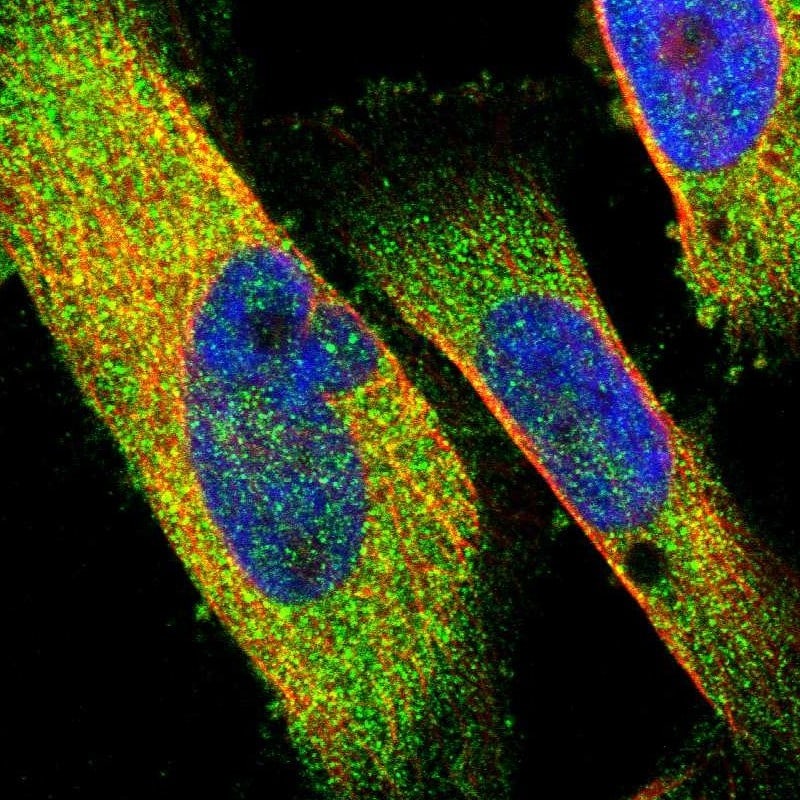 NDP52 Antibody - BSA Free Immunocytochemistry/ Immunofluorescence: NDP52 Antibody - BSA Free [NBP1-87872]