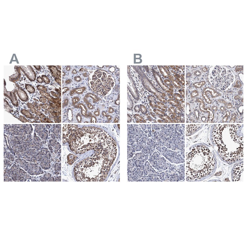 NDP52 Antibody - BSA Free Immunohistochemistry-Paraffin: NDP52 Antibody - BSA Free [NBP1-87872]