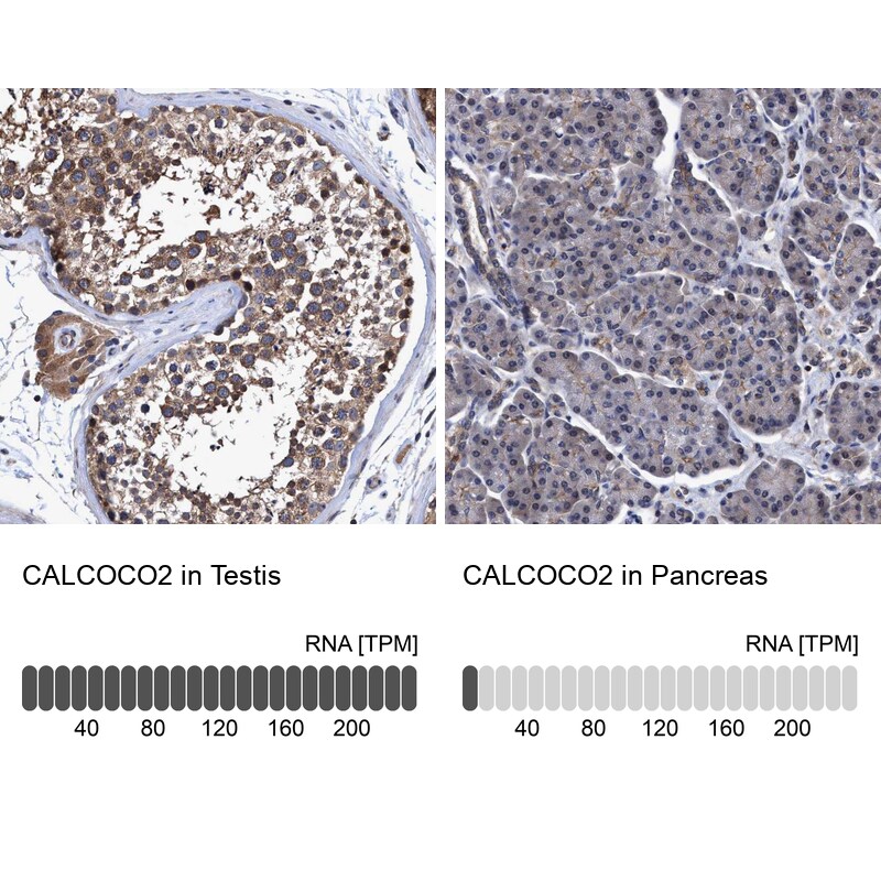 NDP52 Antibody - BSA Free Immunohistochemistry-Paraffin: NDP52 Antibody - BSA Free [NBP1-87872]