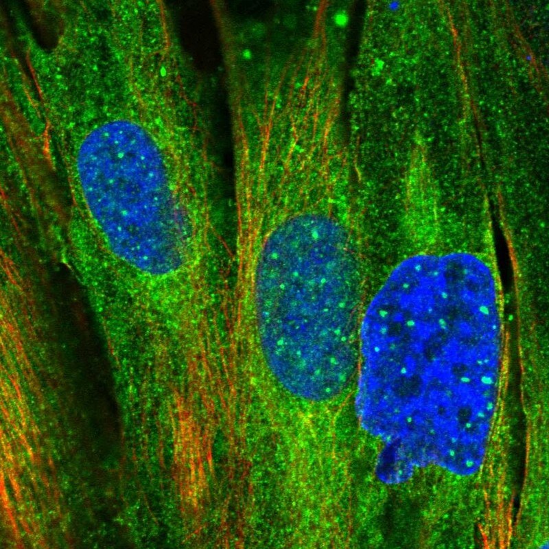 IRAG Antibody - BSA Free Immunocytochemistry/ Immunofluorescence: IRAG Antibody [NBP1-87877]
