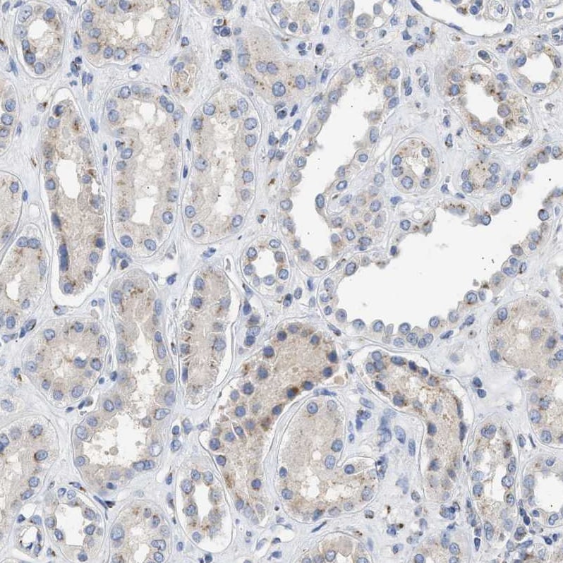 Importin-8 Antibody - BSA Free Immunohistochemistry-Paraffin: Importin-8 Antibody - BSA Free [NBP1-87879]