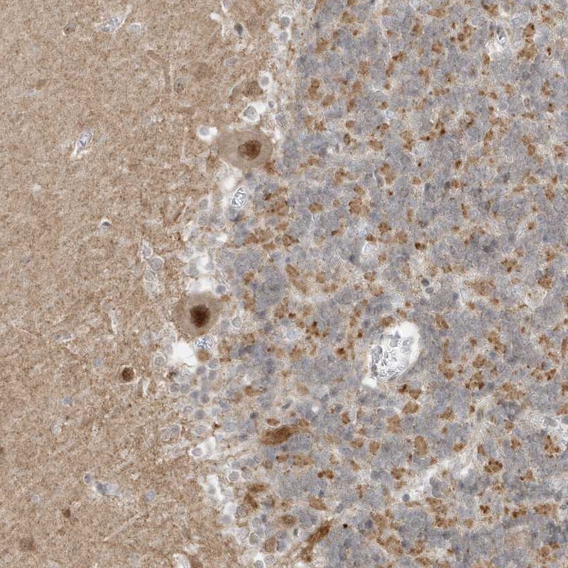 MSL3L1 Antibody - BSA Free Immunohistochemistry-Paraffin: MSL3L1 Antibody [NBP1-87882]