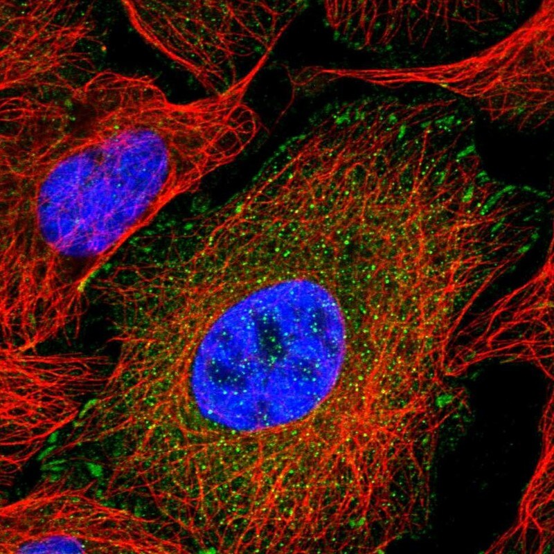 MIG2/Kindlin-2 Antibody - BSA Free Immunocytochemistry/ Immunofluorescence: MIG2/Kindlin-2 Antibody - BSA Free [NBP1-87884]