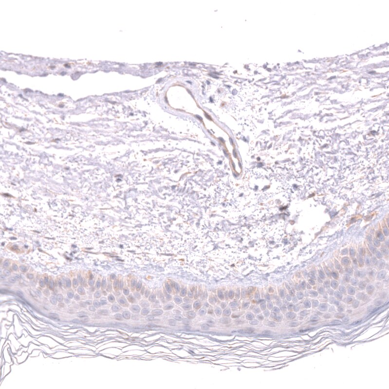 MIG2/Kindlin-2 Antibody - BSA Free Immunohistochemistry-Paraffin: MIG2/Kindlin-2 Antibody - BSA Free [NBP1-87884]