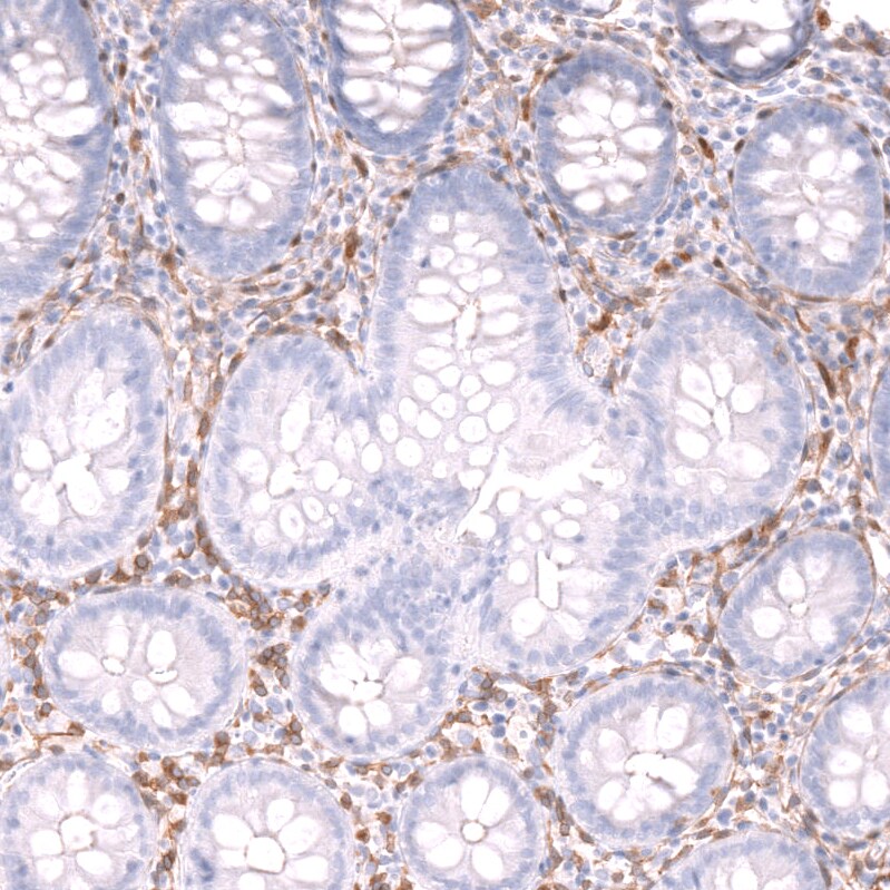 MIG2/Kindlin-2 Antibody - BSA Free Immunohistochemistry-Paraffin: MIG2/Kindlin-2 Antibody - BSA Free [NBP1-87884]