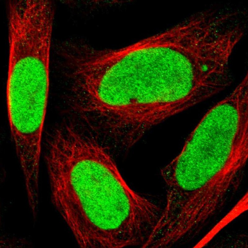 LEDGF Antibody - BSA Free Immunocytochemistry/ Immunofluorescence: LEDGF Antibody [NBP1-87885]