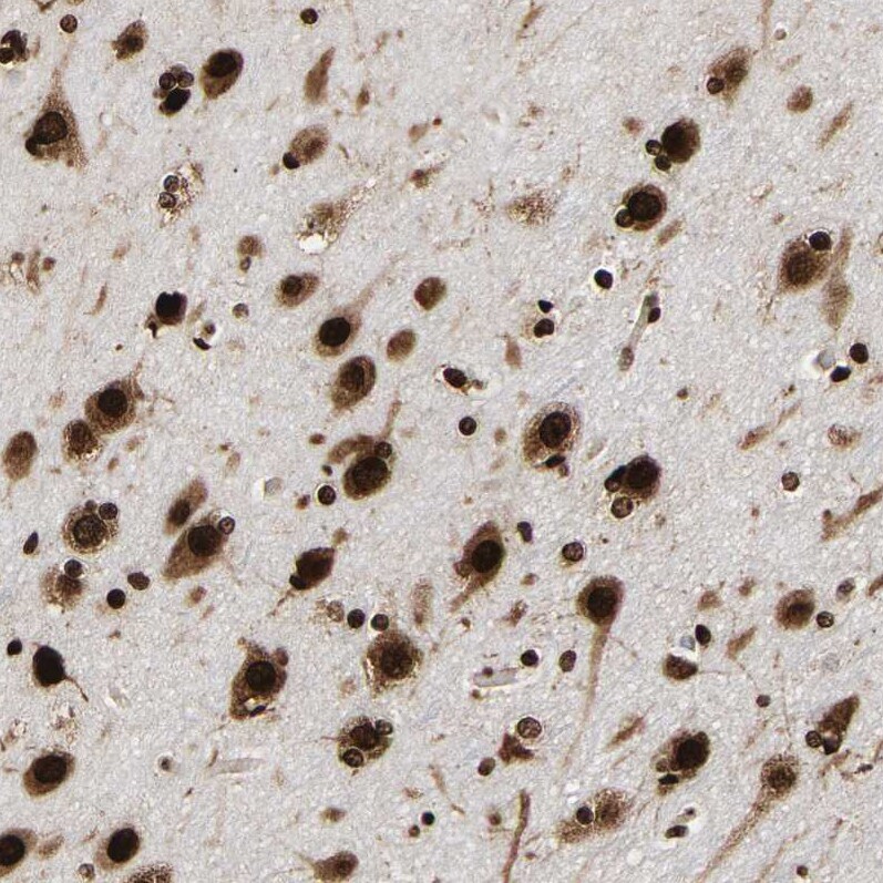 LEDGF Antibody - BSA Free Immunohistochemistry-Paraffin: LEDGF Antibody - BSA Free [NBP1-87885]