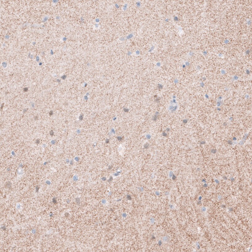 Synaptopodin Antibody - BSA Free Immunohistochemistry-Paraffin: Synaptopodin Antibody - BSA Free [NBP1-87887]