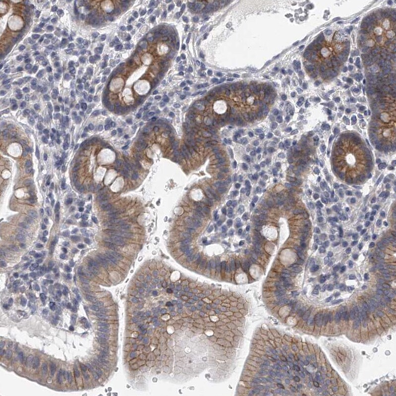 PEPP3 Antibody - BSA Free Immunohistochemistry-Paraffin: PEPP3 Antibody - BSA Free [NBP1-87889]