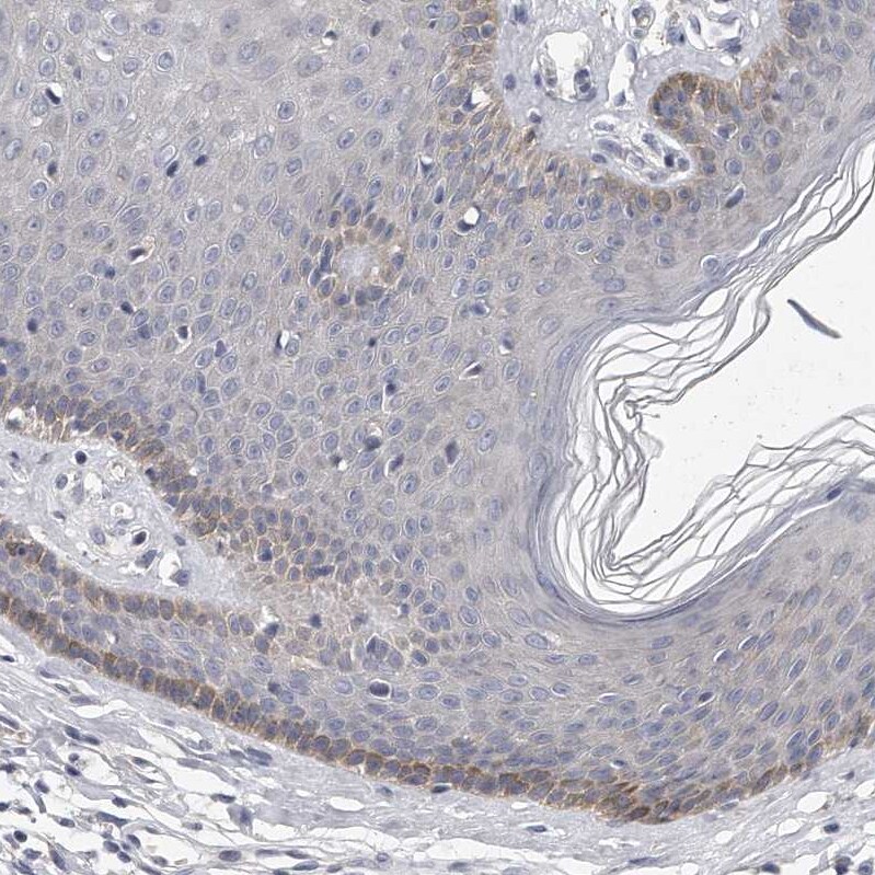 PEPP3 Antibody - BSA Free Immunohistochemistry-Paraffin: PEPP3 Antibody - BSA Free [NBP1-87889]