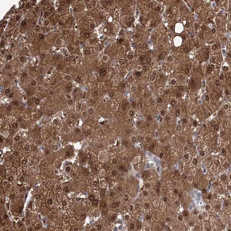 PGR1 Antibody - BSA Free Immunohistochemistry-Paraffin: PGR1 Antibody - BSA Free [NBP1-87892]