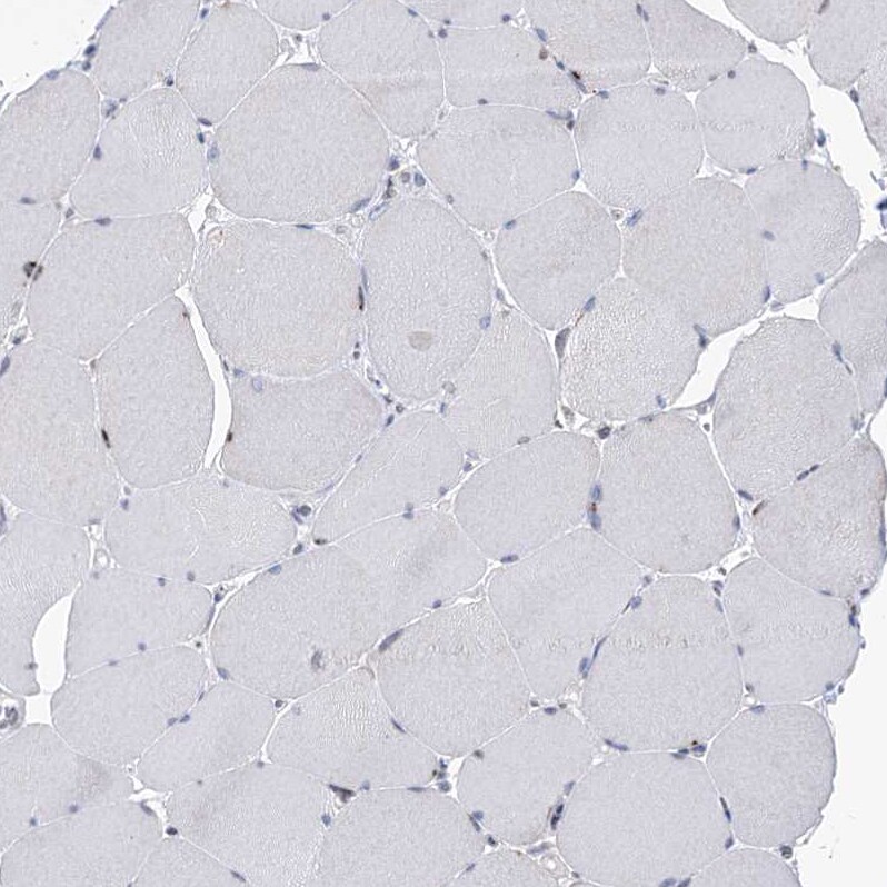PGR1 Antibody - BSA Free Immunohistochemistry-Paraffin: PGR1 Antibody - BSA Free [NBP1-87892]