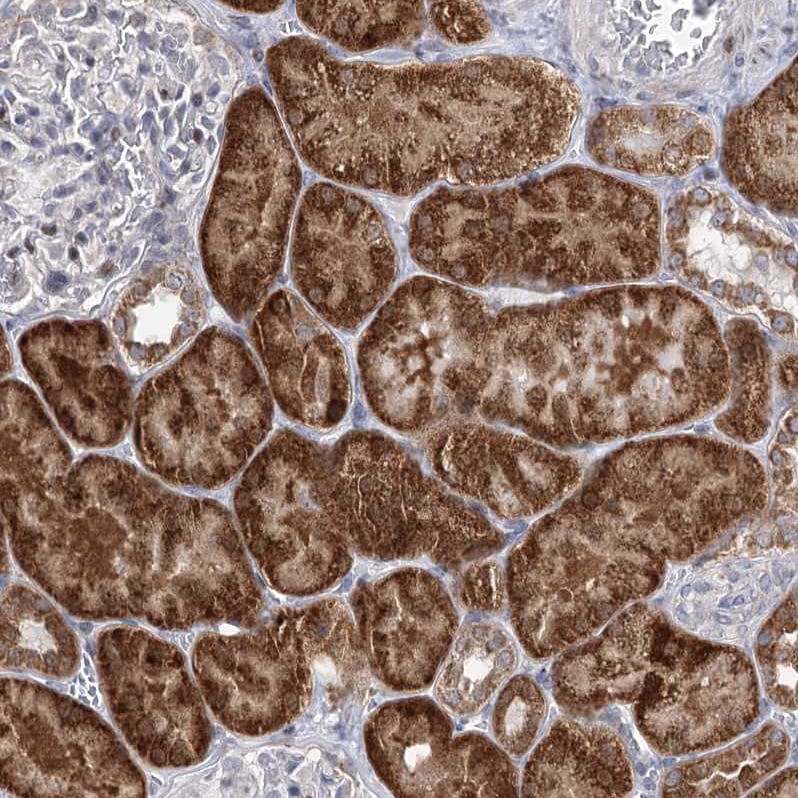 PGR1 Antibody - BSA Free Immunohistochemistry-Paraffin: PGR1 Antibody - BSA Free [NBP1-87892]