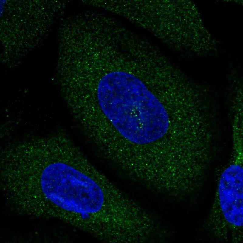 Neurochondrin Antibody - BSA Free Immunocytochemistry/ Immunofluorescence: Neurochondrin Antibody [NBP1-87901]