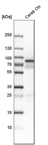 Neurochondrin Antibody - BSA Free Western Blot: Neurochondrin Antibody - BSA Free [NBP1-87901]