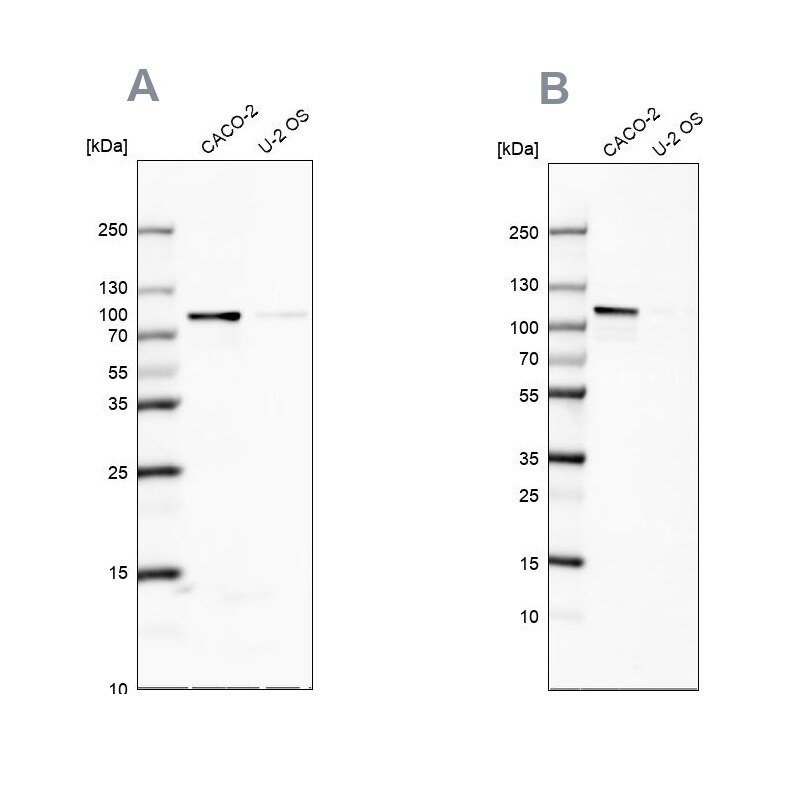 LARP5 Antibody - BSA Free Western Blot: LARP5 Antibody - BSA Free [NBP1-87902]