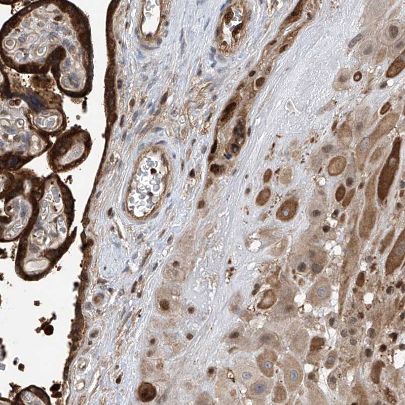 DjC9 Antibody - BSA Free Immunohistochemistry-Paraffin: DjC9 Antibody - BSA Free [NBP1-87903]