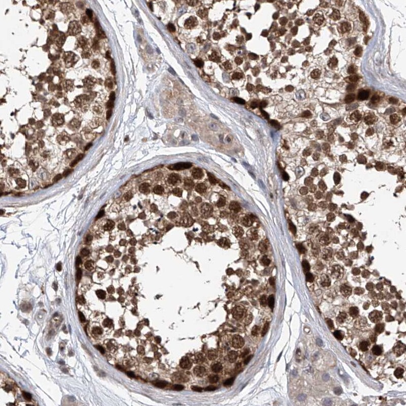 DjC9 Antibody - BSA Free Immunohistochemistry-Paraffin: DjC9 Antibody - BSA Free [NBP1-87903]
