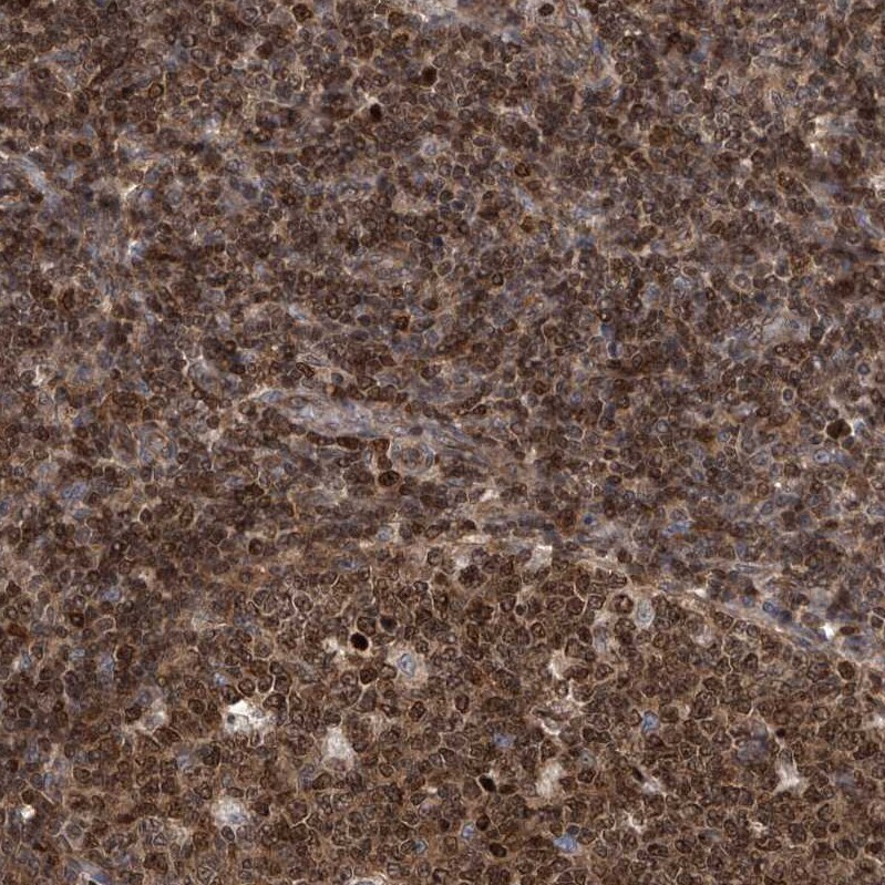 DjC9 Antibody - BSA Free Immunohistochemistry-Paraffin: DjC9 Antibody - BSA Free [NBP1-87903]