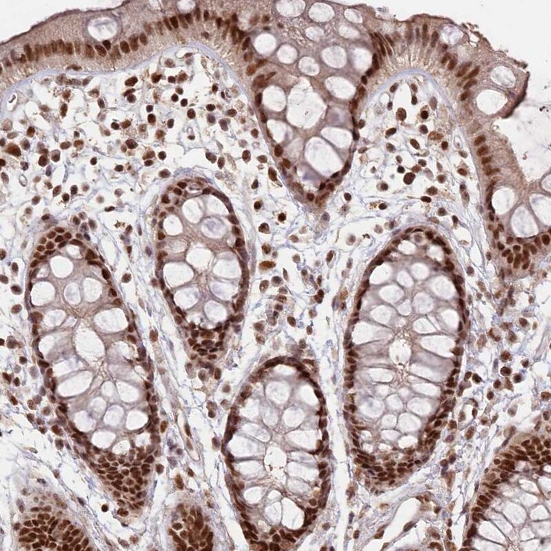 SCC112 Antibody - BSA Free Immunohistochemistry-Paraffin: SCC112 Antibody - BSA Free [NBP1-87904]