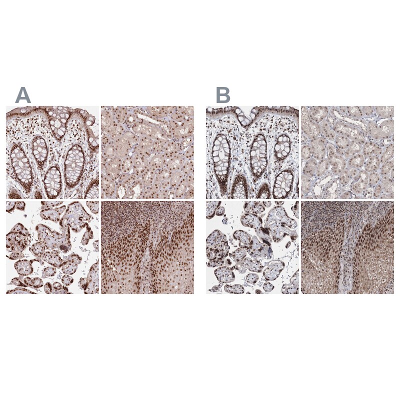 SCC112 Antibody - BSA Free Immunohistochemistry-Paraffin: SCC112 Antibody - BSA Free [NBP1-87904]