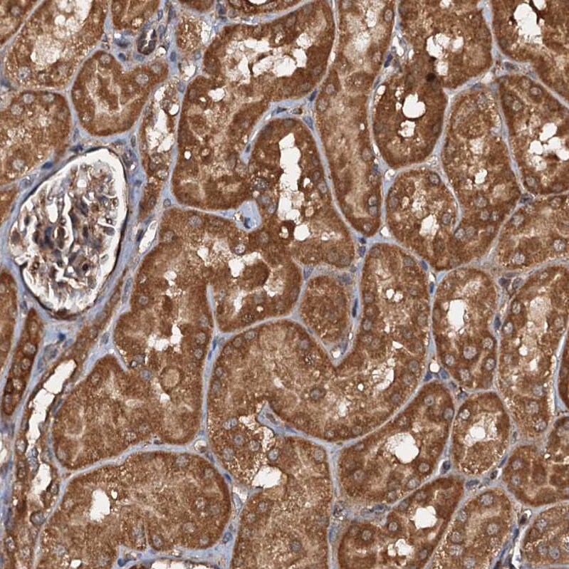 FLJ11506 Antibody - BSA Free Immunohistochemistry-Paraffin: FLJ11506 Antibody - BSA Free [NBP1-87905]