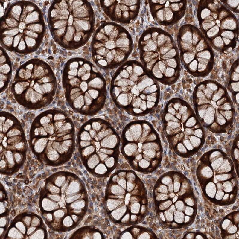 FLJ11506 Antibody - BSA Free Immunohistochemistry-Paraffin: FLJ11506 Antibody - BSA Free [NBP1-87905]