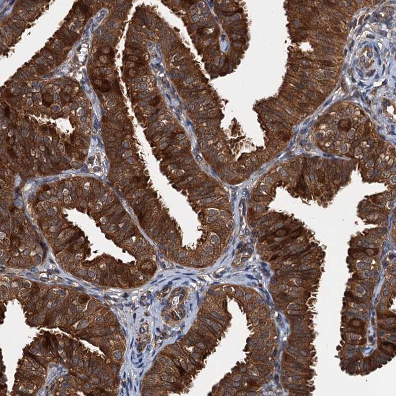 FLJ11506 Antibody - BSA Free Immunohistochemistry-Paraffin: FLJ11506 Antibody - BSA Free [NBP1-87905]