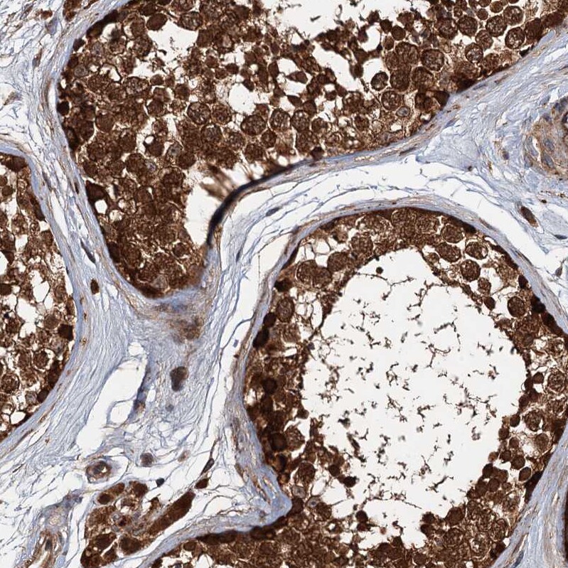 FLJ11506 Antibody - BSA Free Immunohistochemistry-Paraffin: FLJ11506 Antibody - BSA Free [NBP1-87905]