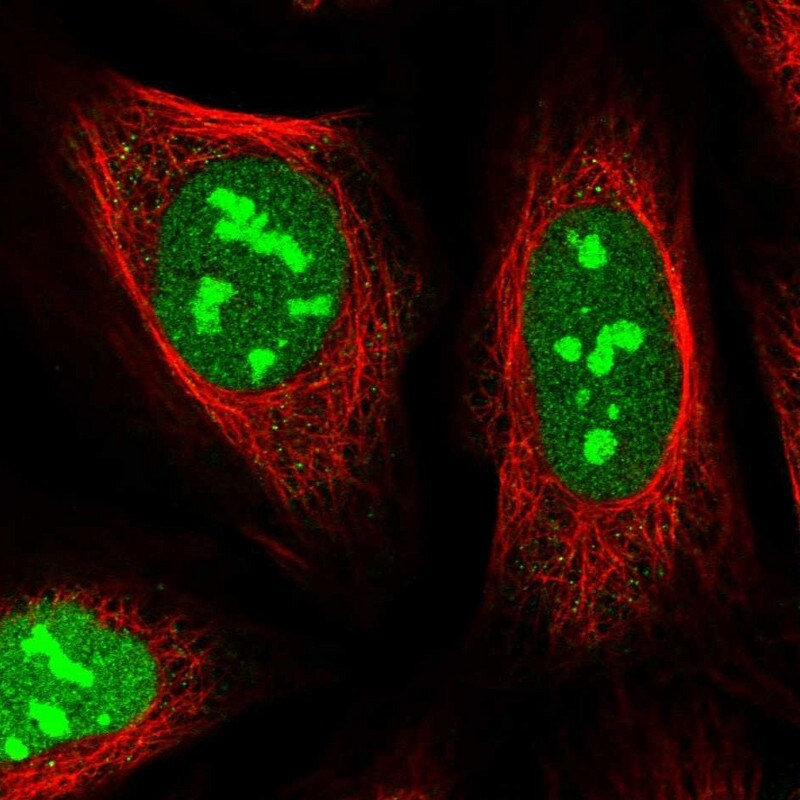 FLJ11184 Antibody - BSA Free Immunocytochemistry/ Immunofluorescence: FLJ11184 Antibody [NBP1-87907]