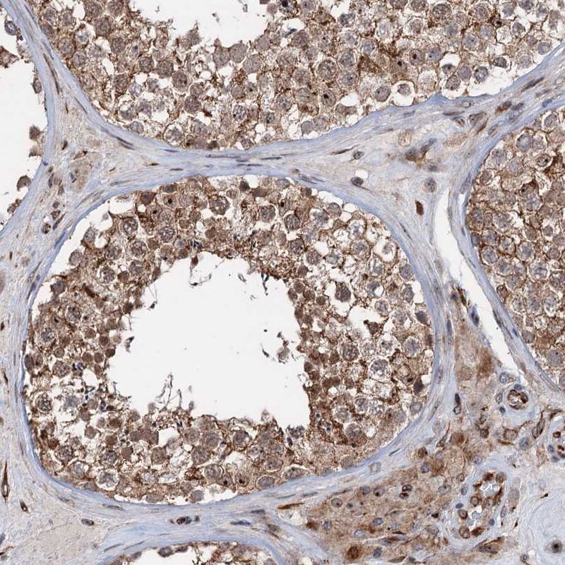 FLJ11184 Antibody - BSA Free Immunohistochemistry-Paraffin: FLJ11184 Antibody - BSA Free [NBP1-87907]