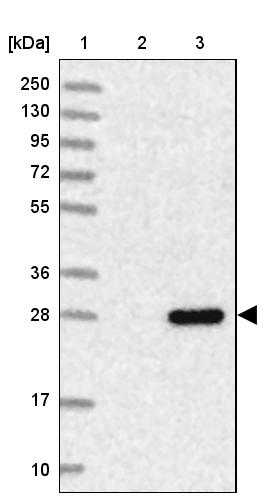 FLJ11184 Antibody - BSA Free Western Blot: FLJ11184 Antibody - BSA Free [NBP1-87907]