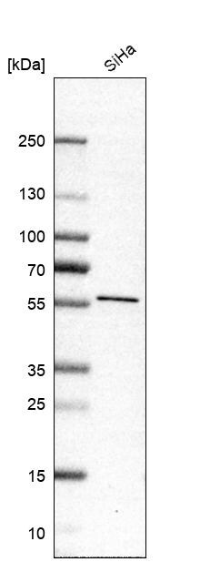 FLJ10815 Antibody - BSA Free Western Blot: FLJ10815 Antibody - BSA Free [NBP1-87910]