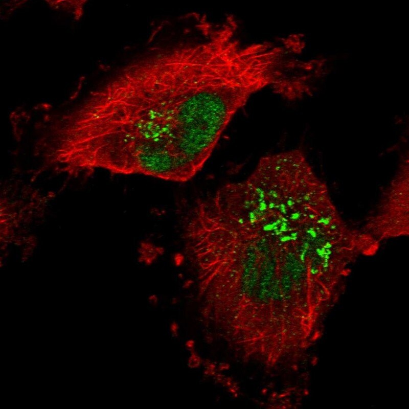 P15RS Antibody - BSA Free Immunocytochemistry/ Immunofluorescence: P15RS Antibody [NBP1-87917]