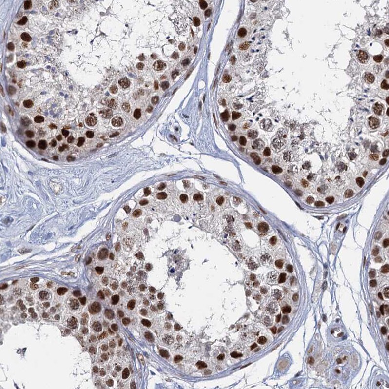 P15RS Antibody - BSA Free Immunohistochemistry-Paraffin: P15RS Antibody - BSA Free [NBP1-87917]