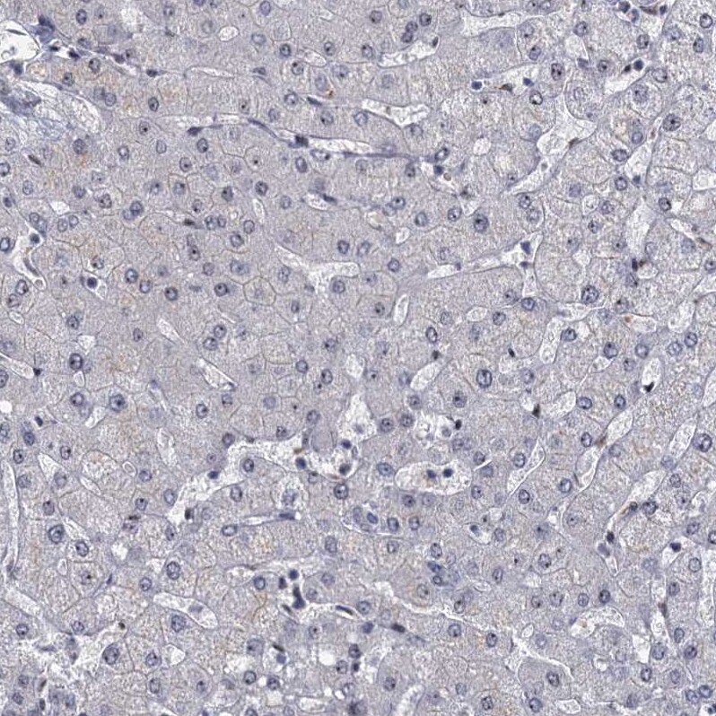 P15RS Antibody - BSA Free Immunohistochemistry-Paraffin: P15RS Antibody - BSA Free [NBP1-87917]