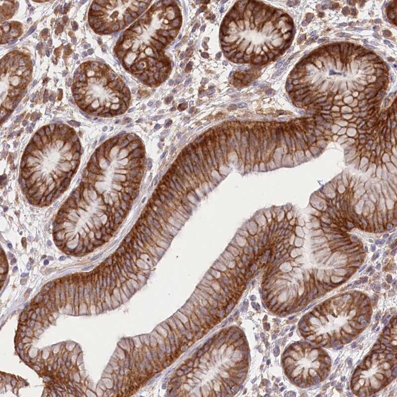 Xylulokinase/XYLB Antibody - BSA Free Immunohistochemistry-Paraffin: Xylulokinase/XYLB Antibody [NBP1-87919]