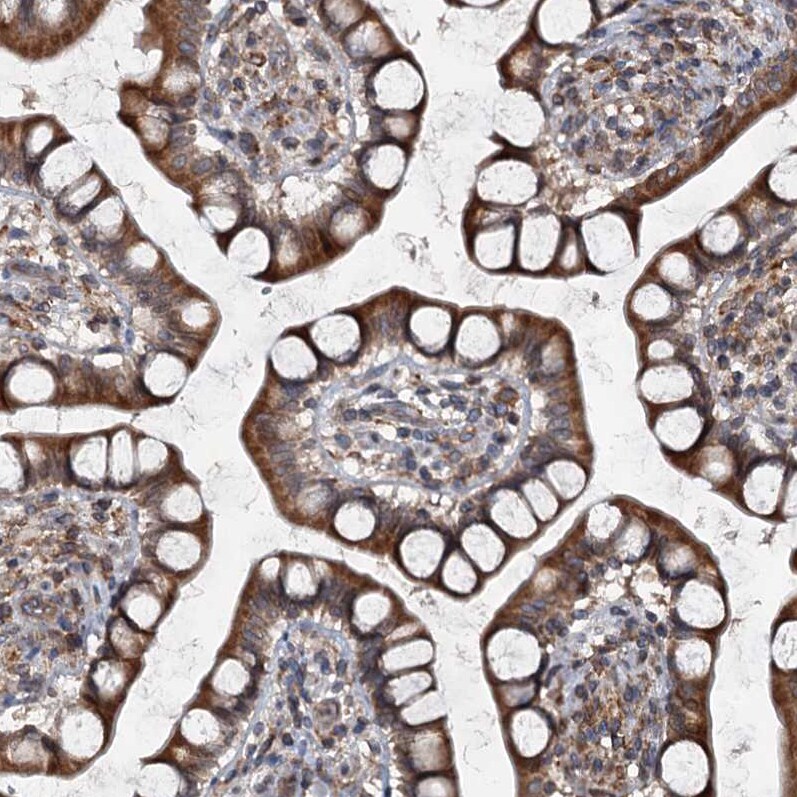 TAPBPR Antibody - BSA Free Immunohistochemistry-Paraffin: TAPBPR Antibody [NBP1-87922]