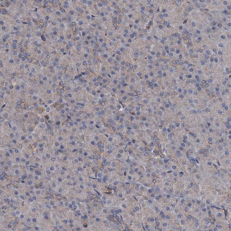 TAPBPR Antibody - BSA Free Immunohistochemistry-Paraffin: TAPBPR Antibody [NBP1-87922]