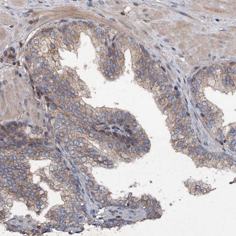 TAPBPR Antibody - BSA Free Immunohistochemistry-Paraffin: TAPBPR Antibody [NBP1-87922]