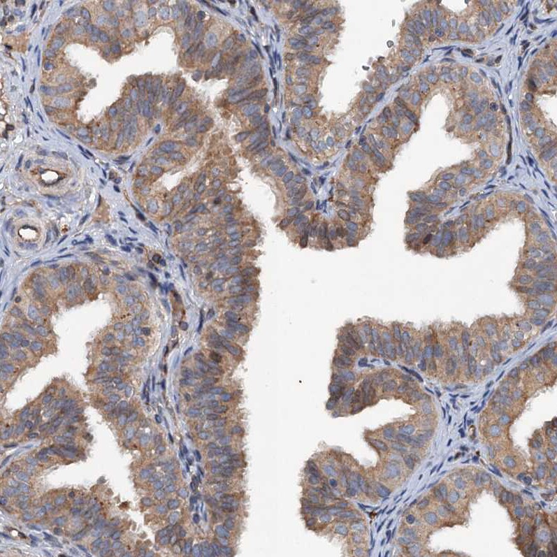 TAPBPR Antibody - BSA Free Immunohistochemistry-Paraffin: TAPBPR Antibody [NBP1-87922]