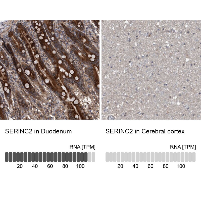 SERINC2 Antibody - BSA Free Immunohistochemistry-Paraffin: SERINC2 Antibody [NBP1-87927]