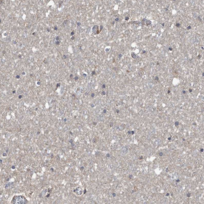 SERINC2 Antibody - BSA Free Immunohistochemistry-Paraffin: SERINC2 Antibody [NBP1-87927]