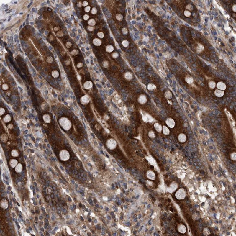 SERINC2 Antibody - BSA Free Immunohistochemistry-Paraffin: SERINC2 Antibody [NBP1-87927]