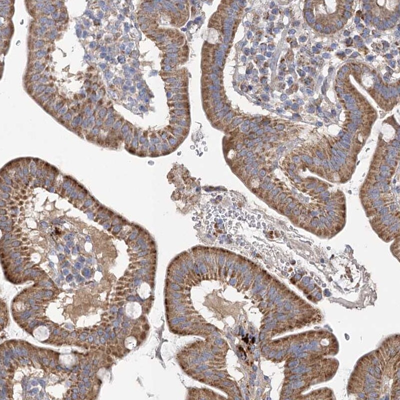 FAM82A Antibody - BSA Free Immunohistochemistry-Paraffin: FAM82A Antibody - BSA Free [NBP1-87934]
