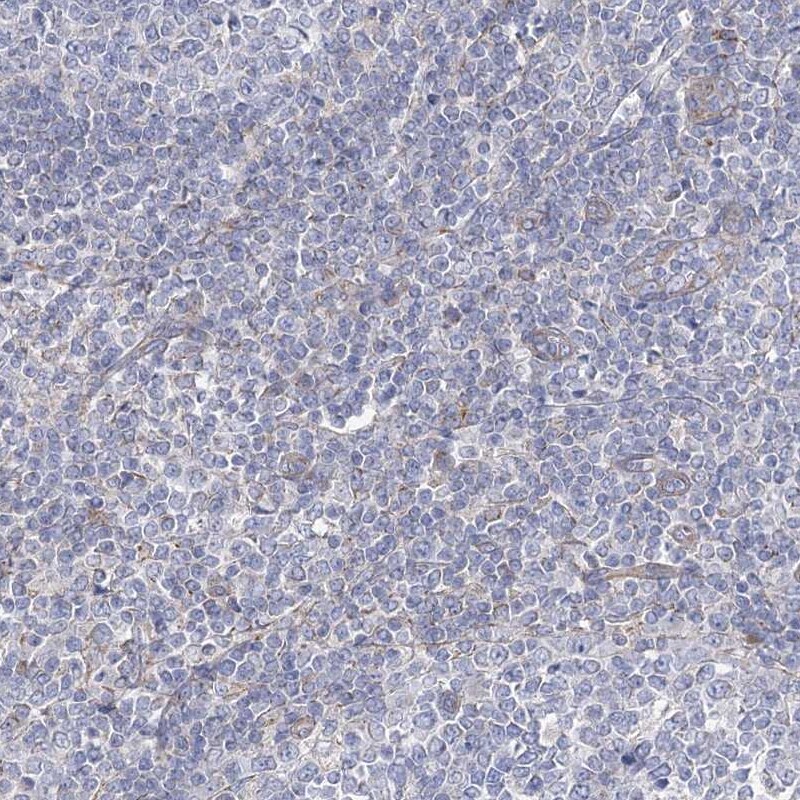 FAM82A Antibody - BSA Free Immunohistochemistry-Paraffin: FAM82A Antibody - BSA Free [NBP1-87934]