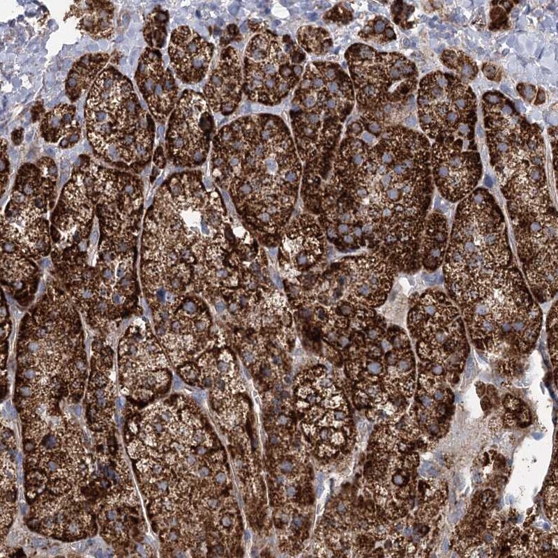 FAM82A Antibody - BSA Free Immunohistochemistry-Paraffin: FAM82A Antibody - BSA Free [NBP1-87934]