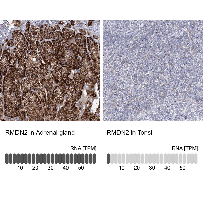 FAM82A Antibody - BSA Free Immunohistochemistry-Paraffin: FAM82A Antibody - BSA Free [NBP1-87934]
