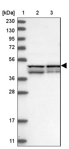 FAM82A Antibody - BSA Free Western Blot: FAM82A Antibody - BSA Free [NBP1-87934]
